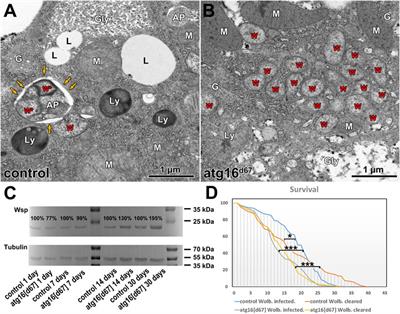 Autophagy controls Wolbachia infection upon bacterial damage and in aging Drosophila